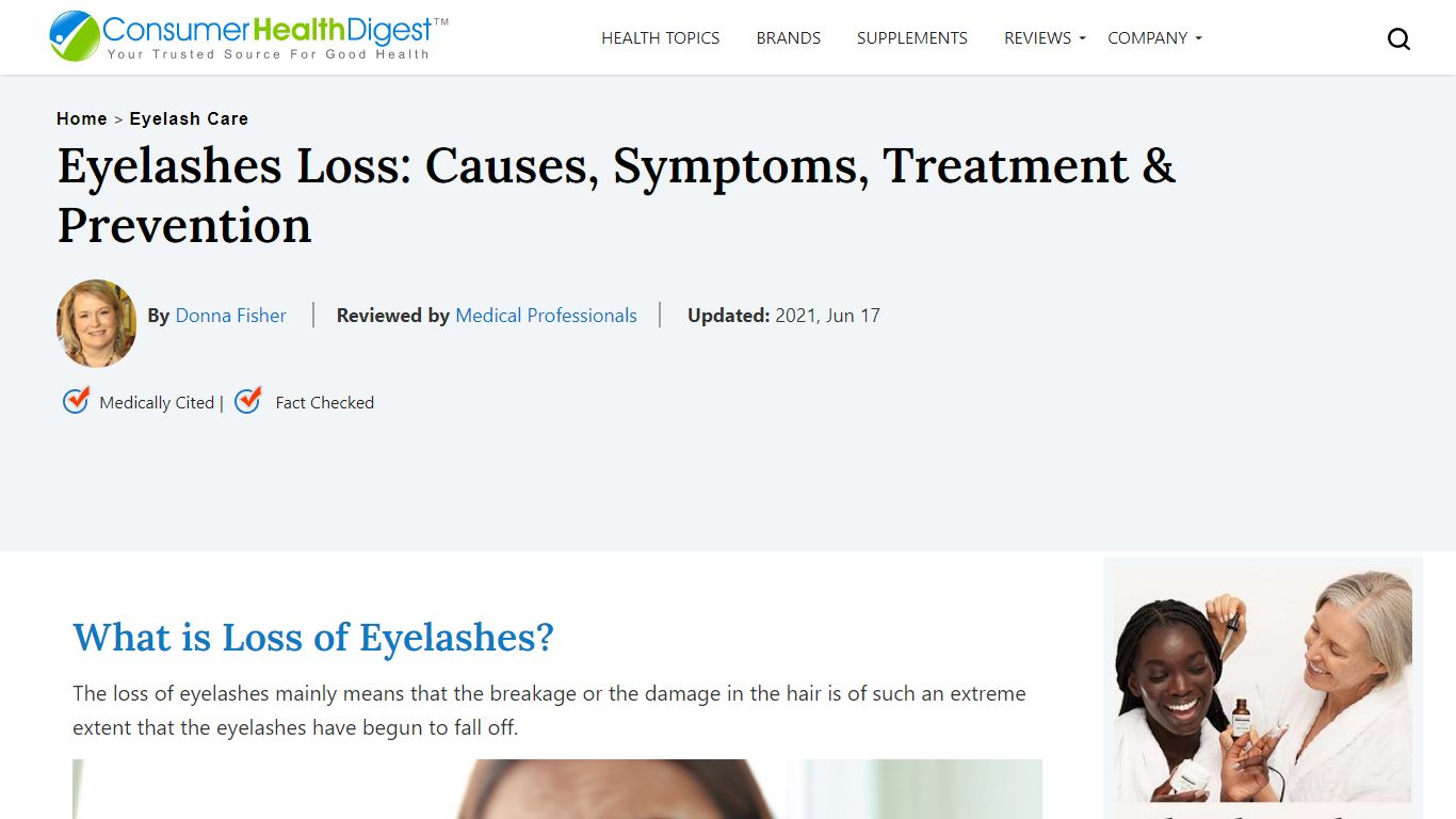 Eyelashes Loss: Causes, Symptoms, Treatment & Prevention
