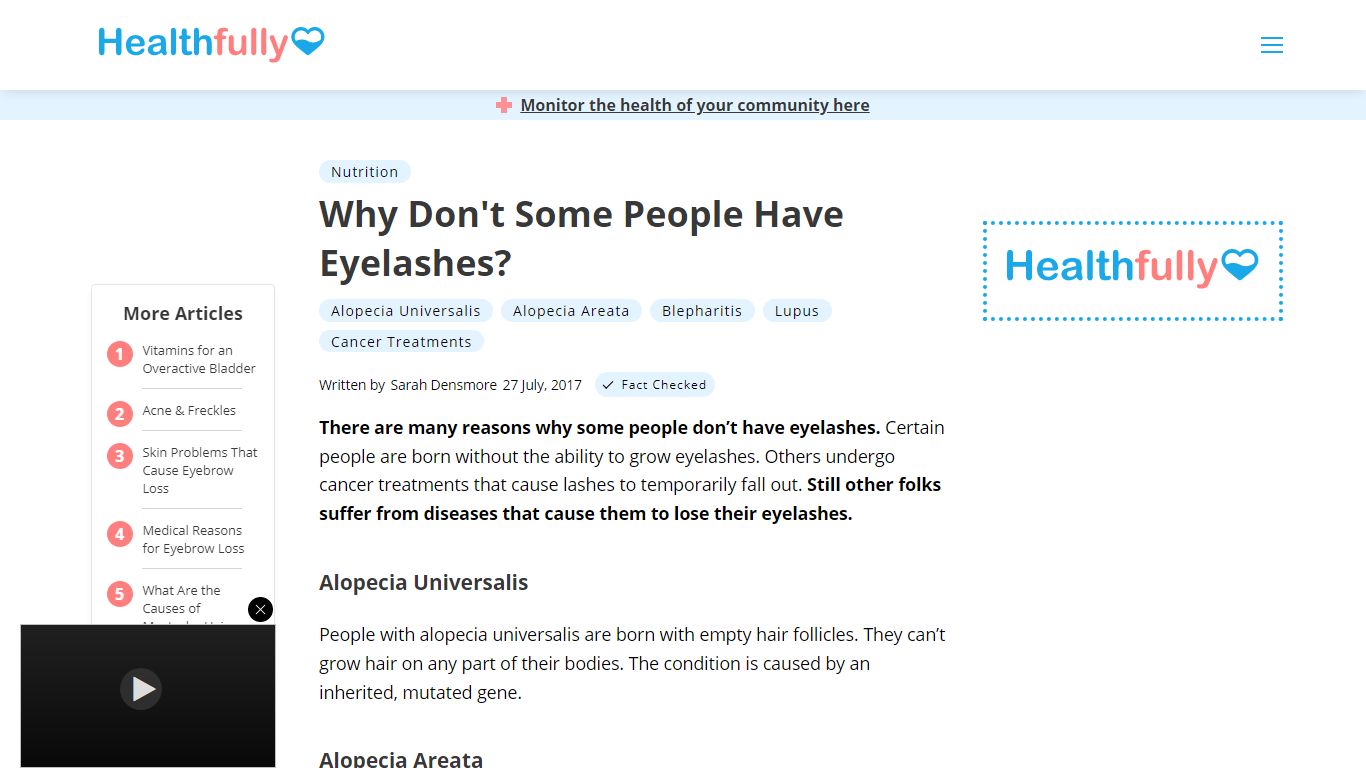 Why Don't Some People Have Eyelashes? | Healthfully