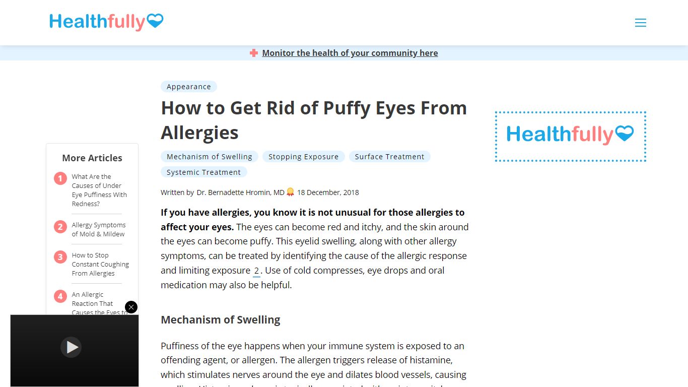 swollen-eyes-from-allergies-beauty-tips