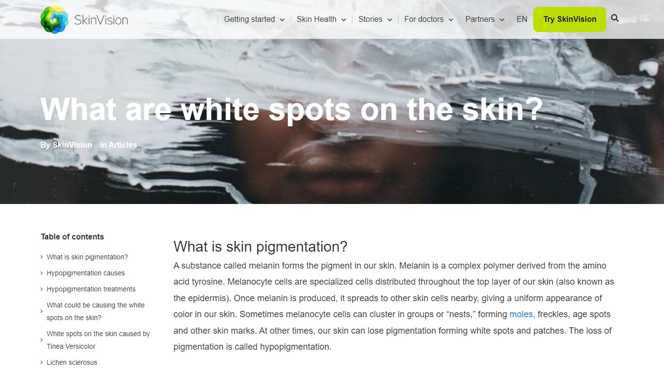 White Spot On Skin Beauty Tips